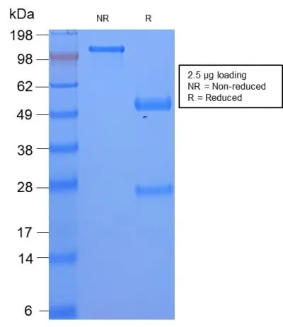 Anti-Serum Amyloid A (SAA/2868R), Biotin conjugate - image 2