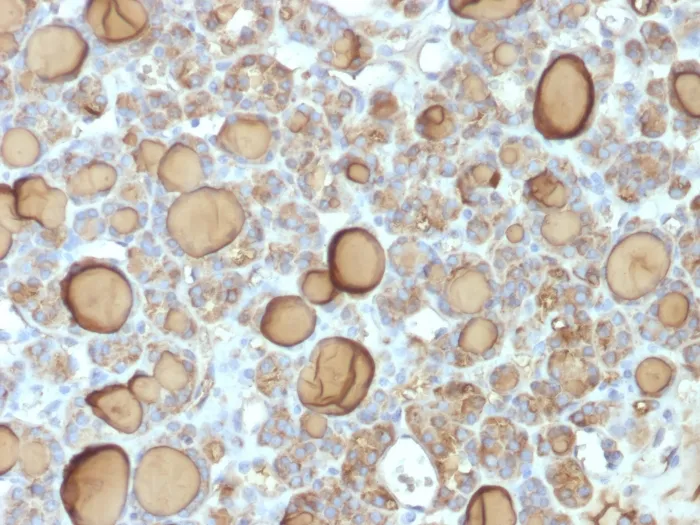 Anti-Thyroglobulin (Thyroidal Cell Marker) (TGB/1970R), Biotin conjugate - image 1