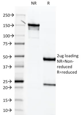 Anti-Mesothelin (Mesothelial Marker) (MSLN/2131), Biotin conjugate - image 4