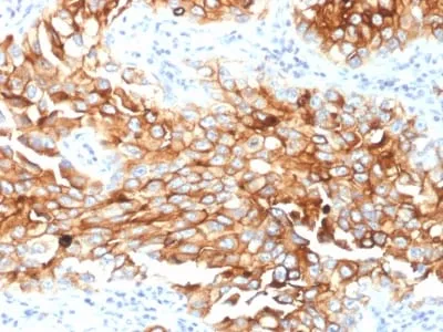 Anti-Mesothelin (Mesothelial Marker) (MSLN/2131), Biotin conjugate - image 1