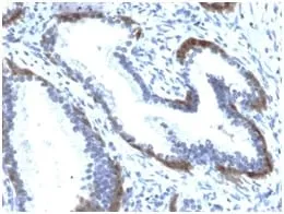 Anti-Cytokeratin 15 (Esophageal Squamous Cell Carcinoma Marker) (KRT15/2103R), Biotin conjugate - image 2