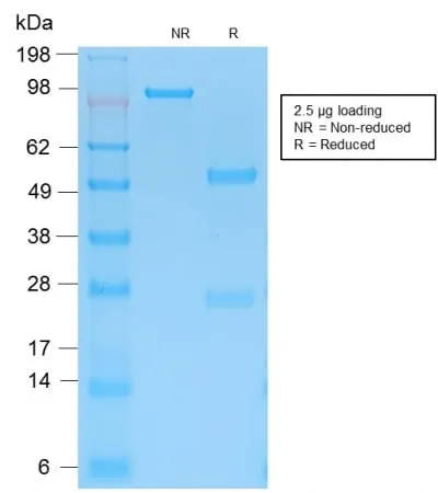 Anti-Cytokeratin 15 (Esophageal Squamous Cell Carcinoma Marker) (KRT15/2103R), Biotin conjugate - image 3