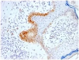 Anti-Cytokeratin 15 (Esophageal Squamous Cell Carcinoma Marker) (KRT15/2103R), Biotin conjugate - image 1