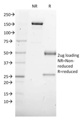 Anti-SOX4 (Master Regulator of Epithelial-Mesenchymal Transition) (SOX4/2540), Biotin conjugate - image 3