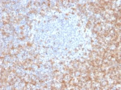 Anti-CD5 (Mantle Cell Lymphoma Marker) (CD5/2416), Biotin conjugate - image 1