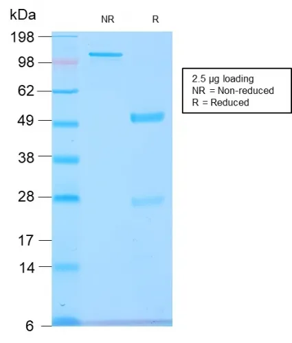 Anti-GnRH-Receptor / LH-RH Receptor(GNRHR/2982R), CF740 conjugate - image 1