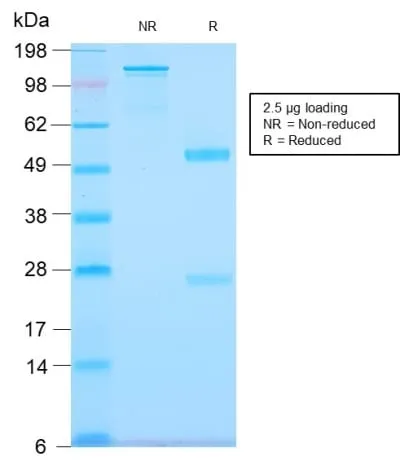 Anti-Tenascin C (Stromal Marker For Epithelial Malignancy) (TNC/2981R), CF740 conjugate - image 2