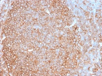 Anti-HLA-Pan (MHC II) (HLA-Pan/2967R), CF740 conjugate - image 1