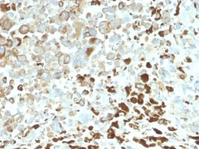 Anti-NGF-Receptor (p75) / CD271 (Soft Tissue Tumor Marker) (NGFR/2550R), CF405S conjugate - image 1