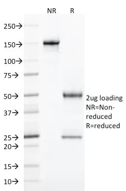 Anti-CD103 / Integrin alpha E (T-Cell Lymphoma & Hairy Cell Leukemia Marker) (ITGAE/2474), CF405S conjugate - image 4