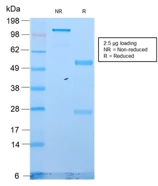 Anti-Cytokeratin 18 (KRT18) (KRT18/2819R), CF405S conjugate - image 2