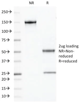 Anti-OLIG2 (Marker of Glial Brain Tumors) (OLIG2/2400), CF405S conjugate - image 2