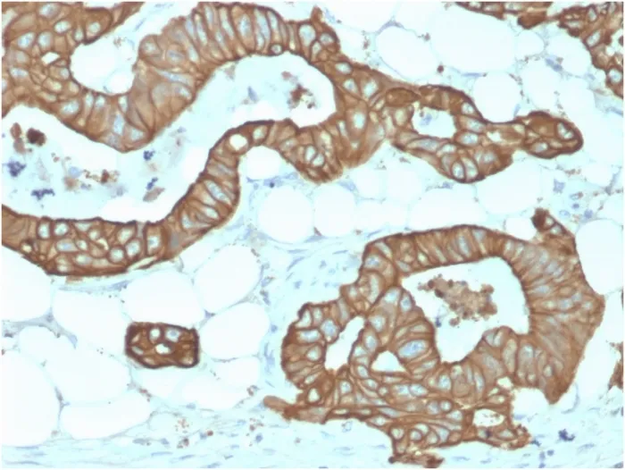 Anti-Cytokeratin 19 (KRT19) (Pancreatic Stem Cell Marker) (KRT19/1959R), CF488A conjugate - image 1