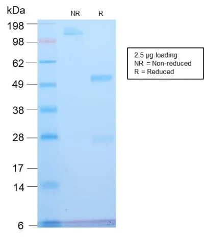 Anti-ATRX / RAD54 (Alpha Thalassemia Mental Retardation) (ATRX/2900R), CF488A conjugate - image 2