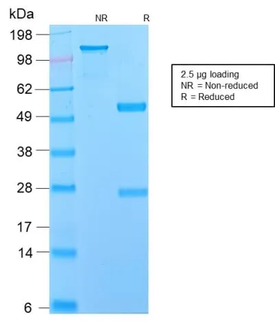 Anti-NGF-Receptor (p75) / CD271 (Soft Tissue Tumor Marker) (NGFR/2550R), CF488A conjugate - image 3