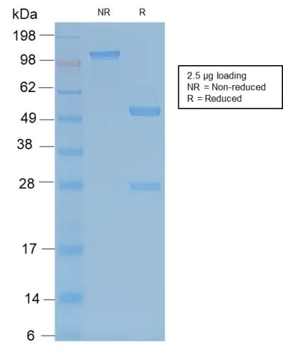 Anti-TRAcP (Tartrate-Resistant Acid Phosphatase) (Hairy Cell Leukemia Marker) (ACP5/2336R), CF488A conjugate - image 2