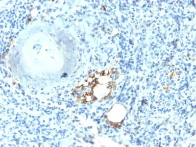 Anti-TRAcP (Tartrate-Resistant Acid Phosphatase) (Hairy Cell Leukemia Marker) (ACP5/2336R), CF488A conjugate - image 1