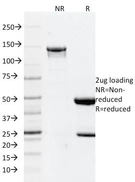 Anti-GFAP (Astrocyte & Neural Stem Cell Marker) (GFAP/2076), CF488A conjugate - image 2