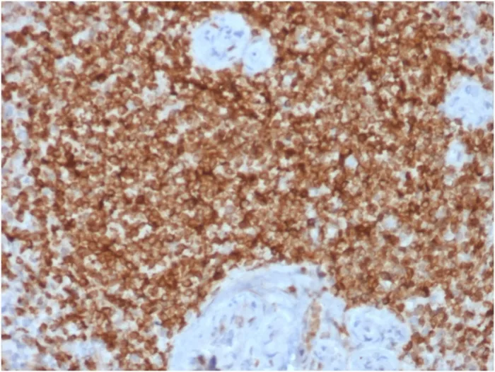 Anti-Bcl-2 (Apoptosis & Follicular Lymphoma Marker) (BCL2/1878R), CF568 conjugate - image 1