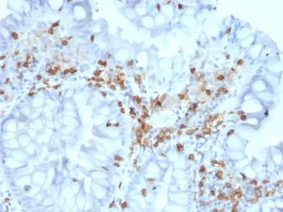 Anti-CD103 / Integrin alpha E (T-Cell Lymphoma & Hairy Cell Leukemia Marker) (ITGAE/2063), CF568 conjugate - image 1