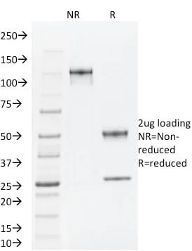 Anti-TLE1 (Synovial Sarcoma Marker) (TLE1/2062), CF568 conjugate - image 4