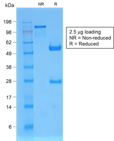 Anti-Beta-2 Microglobulin (Renal Failure & Tumor Marker) (B2M/1857R), CF568 conjugate - image 2