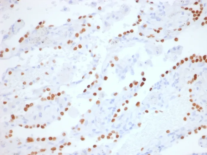 Anti-TTF-1 / NKX2.1 (Thyroid & Lung Epithelial Marker) (NX2.1/1855R), CF568 conjugate - image 1