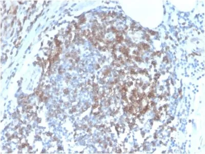 Anti-CD6 (Negative Marker of T-regulatory Cells) (C6/2884R), CF568 conjugate - image 1