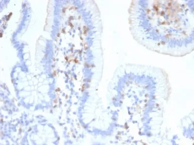 Anti-CD103 / Integrin alpha E (T-Cell Lymphoma & Hairy Cell Leukemia Marker) (ITGAE/2474), CF568 conjugate - image 1