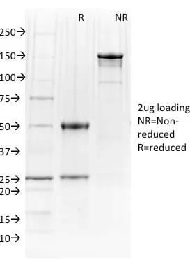 Anti-PU.1 (SPI-1) (B-Cell Marker) (PU1/2146), CF594 conjugate - image 6