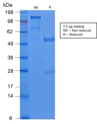 Anti-Cytokeratin 8 (KRT8) (KRT8/2174R), CF594 conjugate - image 2