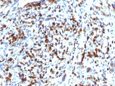 Anti-MyoD1 (Rhabdomyosarcoma Marker) (MYOD1/2075R), CF594 conjugate - image 1