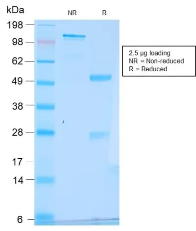Anti-pS2 / pNR-2 / TFF1 (Estrogen-Regulated Protein) (TFF1/2969R), CF594 conjugate - image 1
