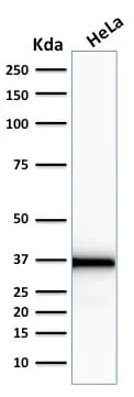 Anti-Emerin (Papillary Thyroid Carcinoma and EDMD Marker) (EMD/2167), CF594 conjugate - image 4