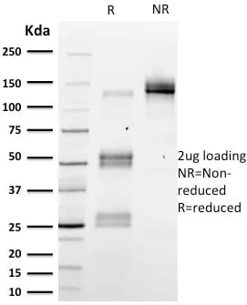 Anti-Emerin (Papillary Thyroid Carcinoma and EDMD Marker) (EMD/2167), CF594 conjugate - image 5
