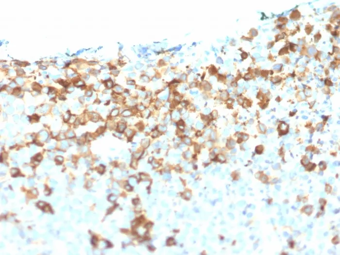 Anti-NGF-Receptor (p75) / CD271 (Soft Tissue Tumor Marker) (NGFR/1964), CF594 conjugate - image 1