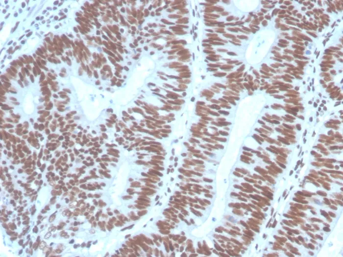 Anti-PAX2 (Renal Cell & Ovarian Carcinoma Marker) (PAX2/1104), CF594 conjugate - image 1
