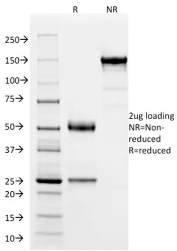 Anti-SOX9 / SRY-box 9 (SOX9/2387), CF594 conjugate - image 4