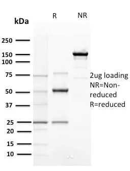 Anti-Cyclin E (G1/S-Phase Cyclin) (CCNE1/2460), CF594 conjugate - image 3