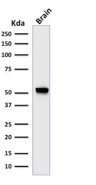 Anti-GFAP (Astrocyte & Neural Stem Cell Marker) (rASTRO/789), CF640R conjugate - image 3