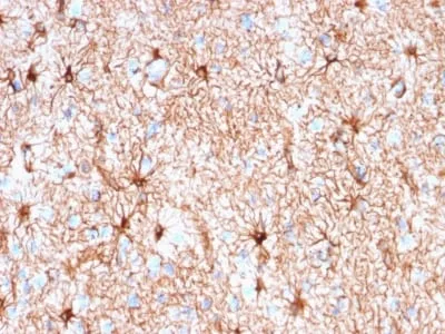 Anti-GFAP (Astrocyte & Neural Stem Cell Marker) (rASTRO/789), CF640R conjugate - image 1