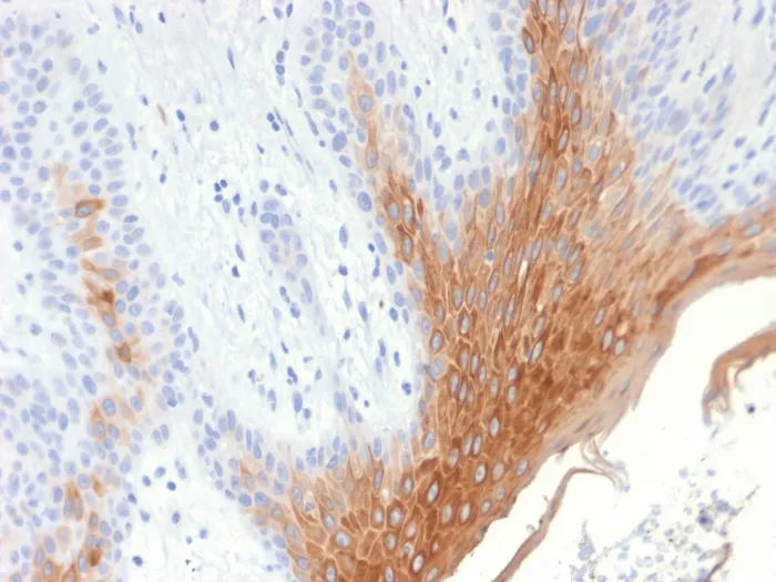 Anti-Cytokeratin 10 (KRT10) (Suprabasal Epithelial Marker) (KRT10/1990R), CF640R conjugate - image 1