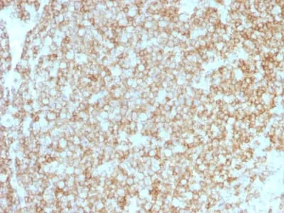 Anti-CD45 / LCA (Leucocyte Marker) (PTPRC/1783R + PTPRC/1975R), CF640R conjugate - image 1