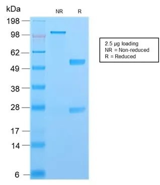 Anti-S100A4 (Marker of Tumor Metastasis) (S100A4/2750R), CF640R conjugate - image 2