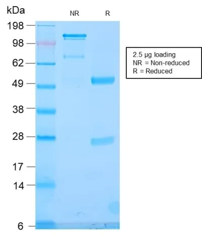 Anti-TLE1 (Synovial Sarcoma Marker) (TLE1/2946R), CF640R conjugate - image 2