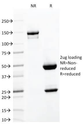 Anti-CD103 / Integrin alpha E (T-Cell Lymphoma & Hairy Cell Leukemia Marker) (ITGAE/2063), CF640R conjugate - image 4