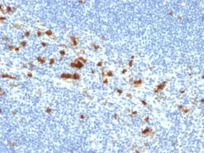 Anti-CD103 / Integrin alpha E (T-Cell Lymphoma & Hairy Cell Leukemia Marker) (ITGAE/2474), CF640R conjugate - image 3