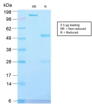 Anti-Alkaline Phosphatase (Placental) / PLAP (Germ Cell Tumor Marker) (ALPP/2899R), CF640R conjugate - image 2