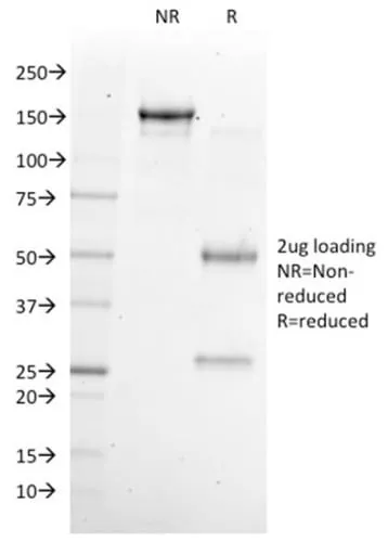 Anti-NKX6.1 (Marker for Pancreatic and Duodenal Neuroendocrine Tumors) (NKX61/2561), CF640R conjugate - image 2