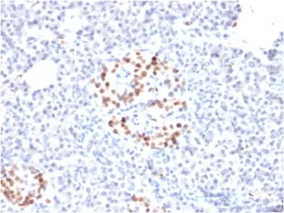 Anti-NKX6.1 (Marker for Pancreatic and Duodenal Neuroendocrine Tumors) (NKX61/2561), CF640R conjugate - image 1